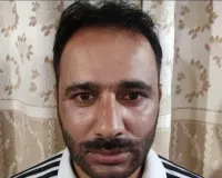 Conman Bilal (Alias Dr Bilal) Arrested From Delhi, Slapped Under PSA : J&K Police